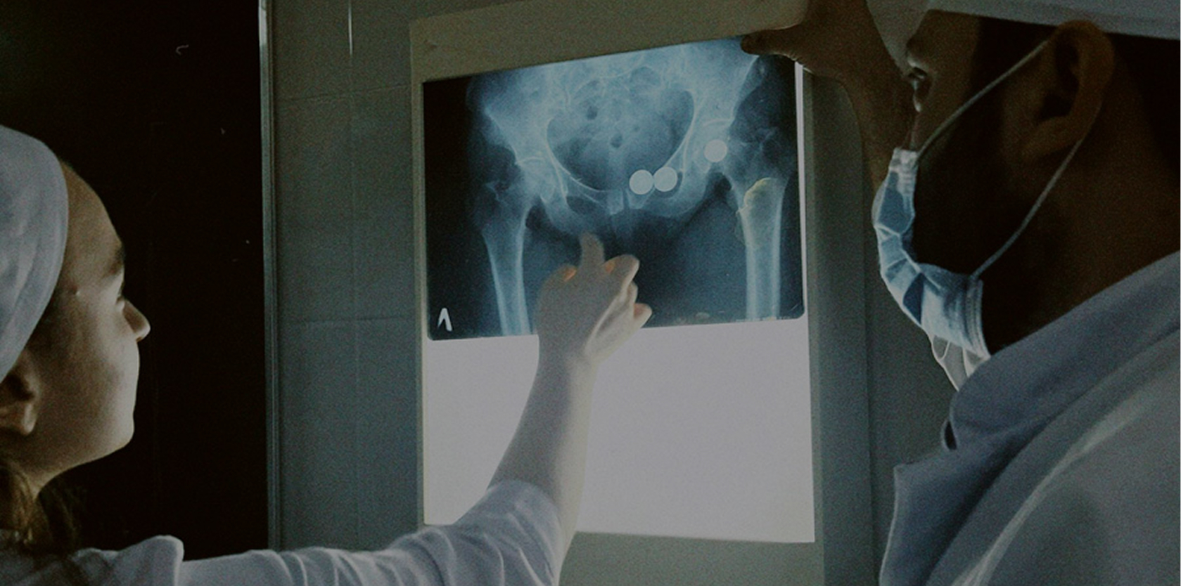 Hip Arthroscopy